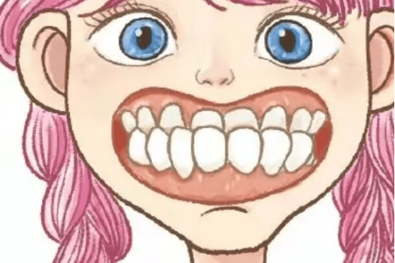 龅牙能不能矫正 有龅牙可以矫正吗