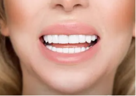 种植牙流程需要多长时间 种牙需要多久完成