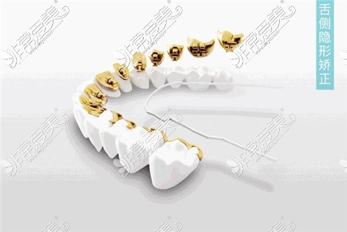 杭州牙齿矫正恢复效果不错的牙科排名名单一览
