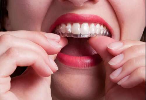 福建牙齿矫正医院排名前三名公开，维乐口腔又是排名第一