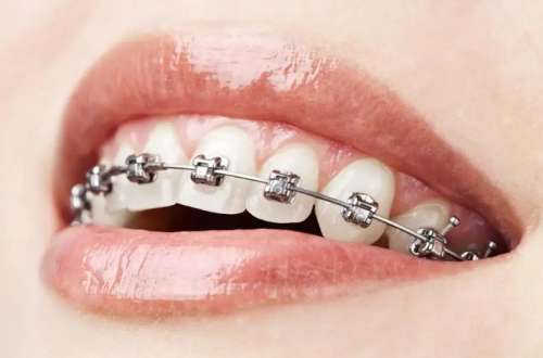 西安有名的地包天牙齿矫正医院排名榜，西安泰康拜博口腔来到了第一名