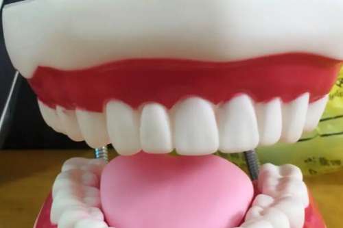 牙齿矫正最佳年龄段多少岁？孩子的矫正黄金期可不要错过！